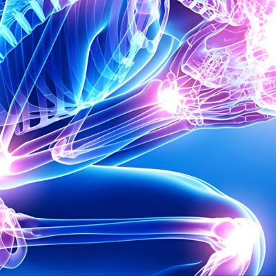 Dor Neuropática e Neuromodulação